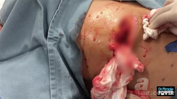 30 yıl boyunca baş ağrısıyla yaşadı! Nedeni şoke etti... 131