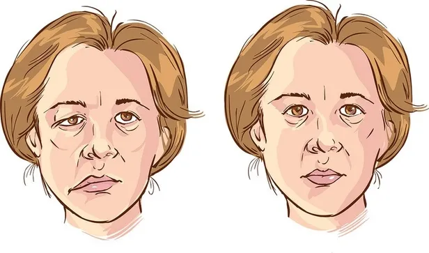 ramsay-hunt-sendromu-ne-demek-tedavisi-var-mi-ilyas-yalcintasin-hastaligi-ramsay-hunt-sendromu-neden-olur-beli-1702050345896.jpg Ramsay Hunt sendromu ne demek, tedavisi var mı? İlyas Yalçıntaş'ın hastalığı Ramsay Hunt sendromu neden olur, belirtileri neler? - 4