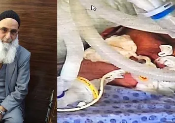 35 yıllık eşini satırla komalık etti