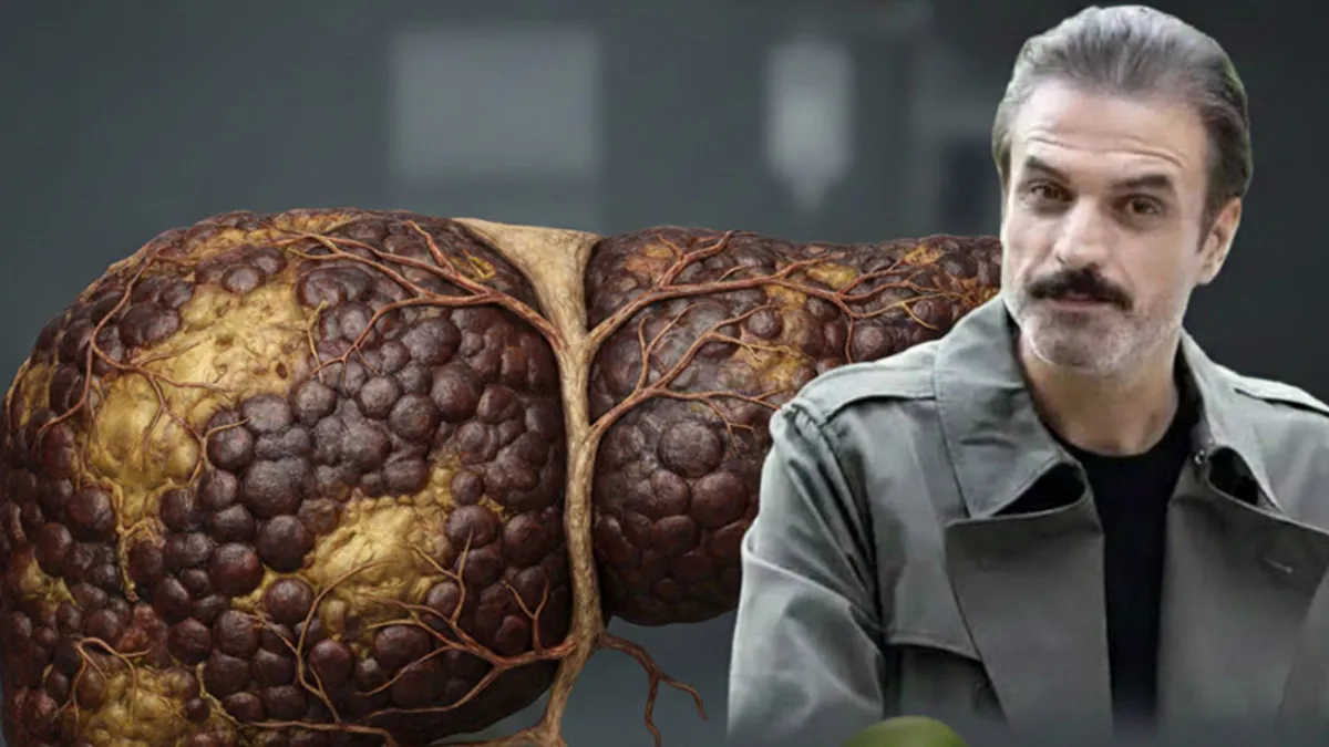 Yanlış diyetin bedeli ağır oldu! Ufuk Özkan için tek umut organ nakli