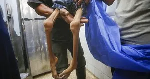 İnsanlık yerle bir... Gazze’de 6 kişi daha açlıktan can verdi!