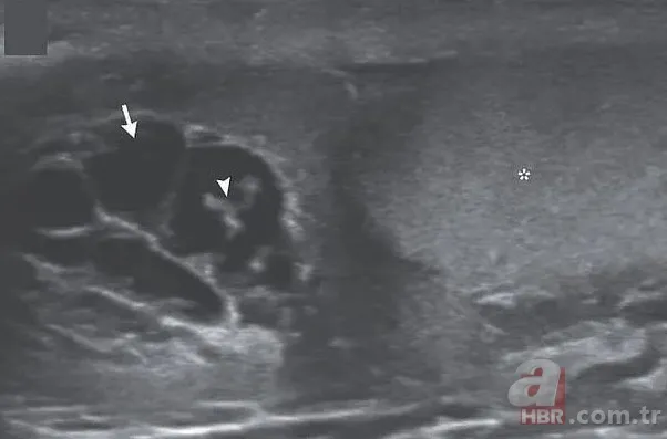 Doktora gitti hayatının şokunu yaşadı 👨⚕️ Sivrisinek ısırığı kabusu oldu 🦟 Dans eden düzinelerce... 6