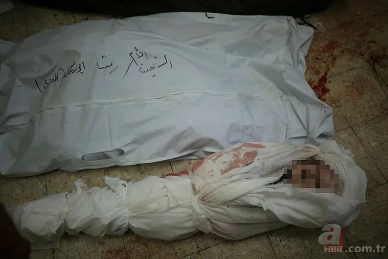 ABD'li doktor soykırımcı İsrail'in acımasızlığını herkese duyurdu: Karnından ve göğsünden vurulmuş çocuklar gördüm 18