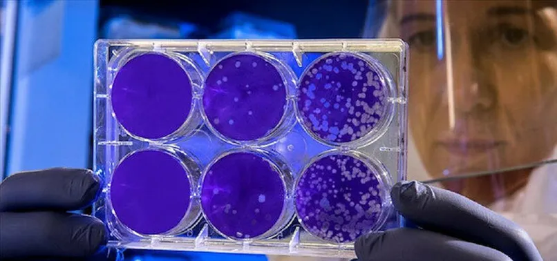 Son dakika: Hantavirüs insandan insana bulaşır mı? Türk profesör açıkladı