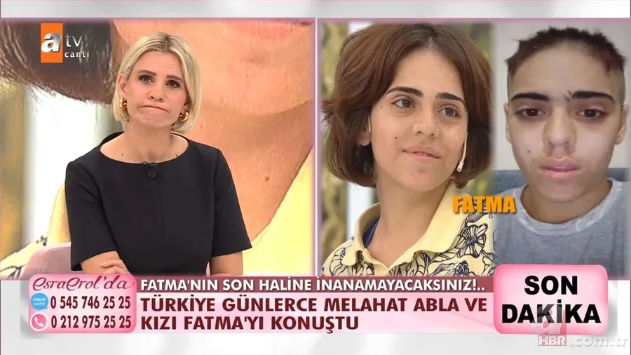 Son haline inanamayacaksınız! Türkiye günlerce onları konuşmuştu - Esra Erol canlı yayında açıkladı 1