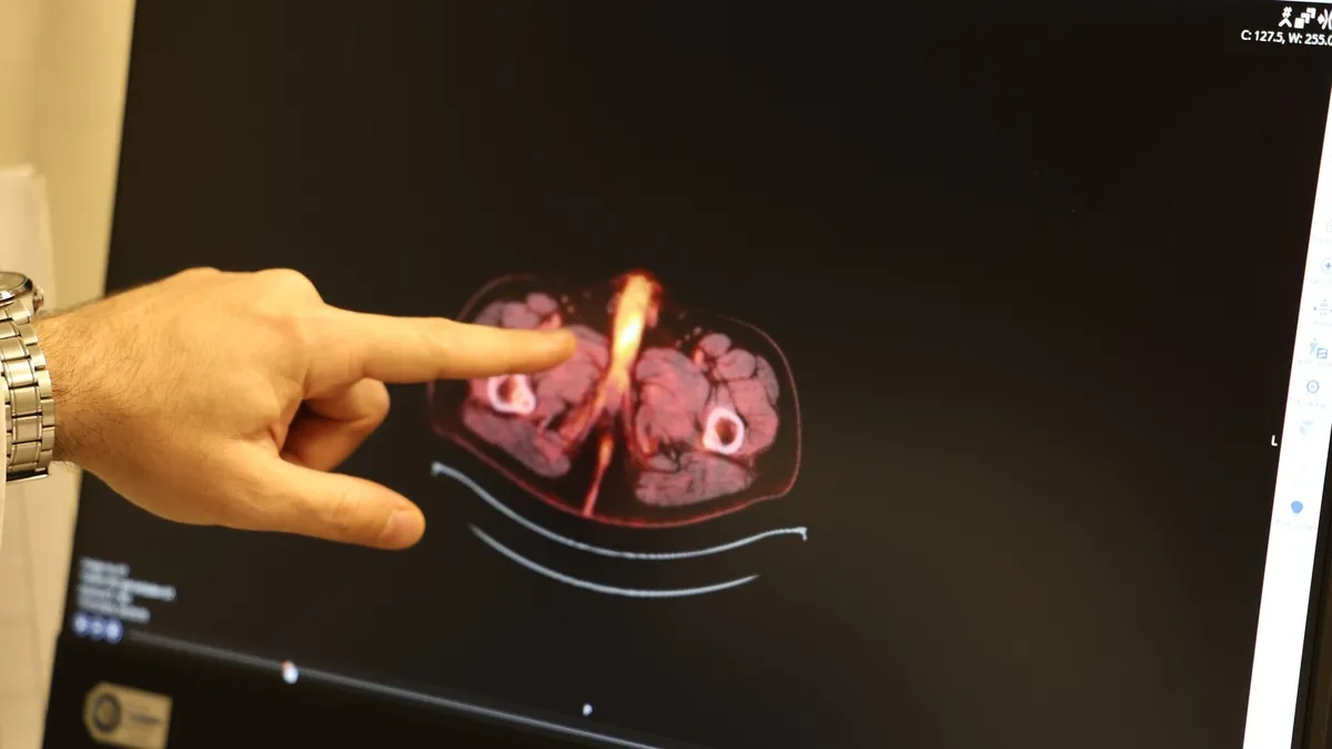 Bu kez Diyarbakır’da görüldü: Bu hastalık dünyada sadece 60 kişide var