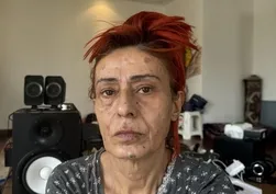 Yıldız Tilbe kimyasallara veda etti! Saçlarında sadece 4 malzeme kullanıyor