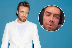 2 sene sonra burnum oldu