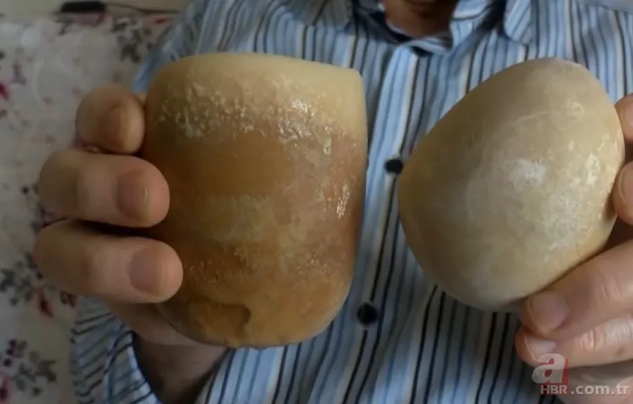 Karın bölgesinde şişlik ve halsizlik şikayetiyle doktora gitti! Karnından çıkanlar şoke etti 15