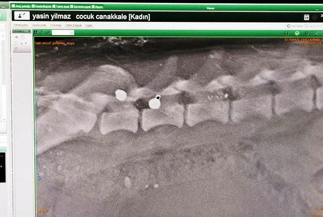 Çanakkale'de sokak köpeğini hedef tahtasına çevirdiler - 3