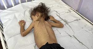 İsrail 24 saatte 5 Filistinliyi daha açlıkla katletti