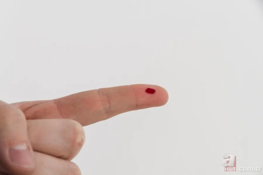 Diyanet'e göre kan almak orucu etkiler mi? Oruçluyken tedavi için kan vermek orucu bozar mı? 4