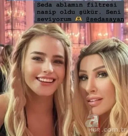 Büşra Pekin’de estetikle yeni birine dönüşenler kervanında! 1 estetiğim var deyince ti’ye alınmıştı… 4 bantla o hale gelmiş! 19