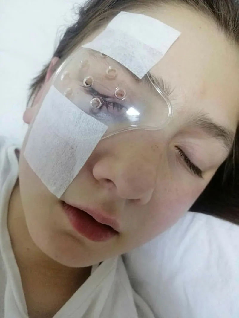 Aydin Da Babasiyla Yastik Savasi Yapan Belinay In Gozune Avizedeki Cam Parcalari Isabet Etti