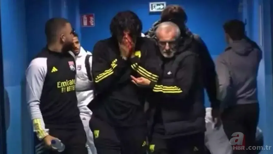 Fransa Birinci Futbol Ligi’nde kanlı gece: Teknik adama korkutan saldırı! Maç ertelendi 8