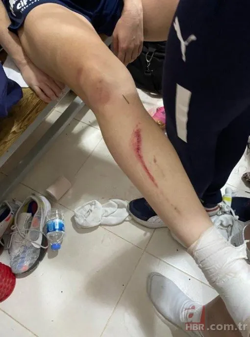 Diyarbakır’da Amed SF - Fenerbahçe Kadın Futbol Süper Ligi maçında kadın futbolcular rakiplerine saldırdı! Tribünlerden yabancı madde yağdı