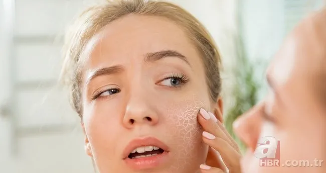 Göz çevresindeki kırışıklıklara doğal çözüm! Haftada 3 kez kullanımla tamamen yok olacaklar 6
