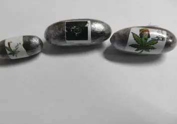 Midesinden 774 parça kapsül çıkarıldı! Ekipler şaştı kaldı