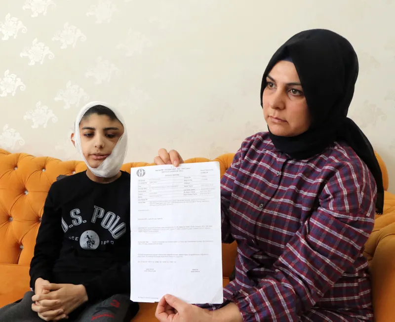 Çenesinin altına kadar indi! Yüzündeki yara her geçen gün büyüyor
