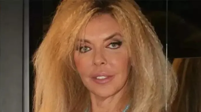 Yeşilçam yıldızı Ahu Tuğba trafik kazası geçirdi! Yoğun bakıma alındı! Son durumu...