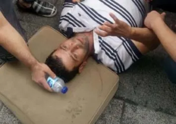 Vatandaşın üzerine sokak lambası düştü