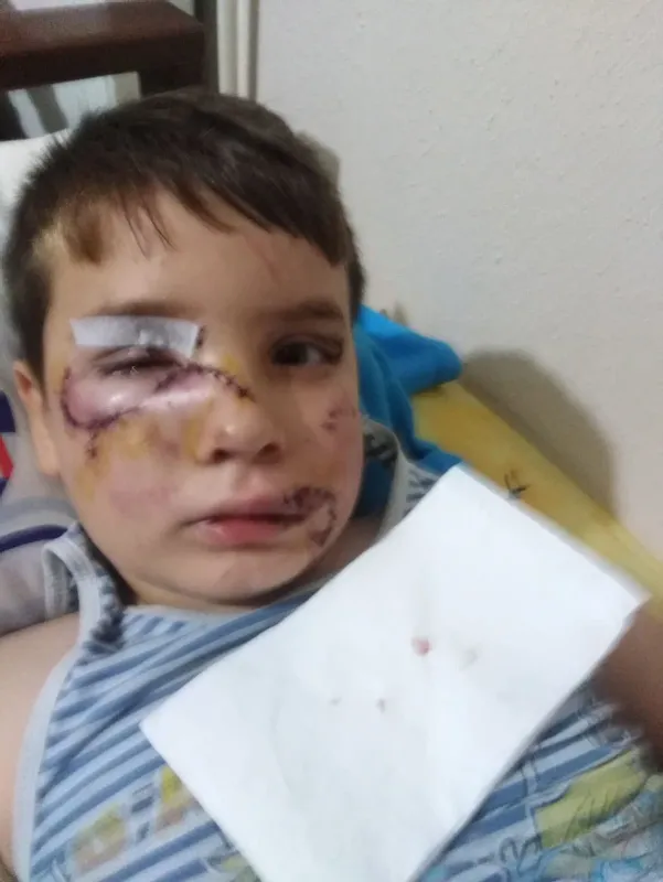 Bir köpek saldırısı haberi daha! 8 yaşındaki Mert'in yüzüne 60 dikiş atıldı - 4