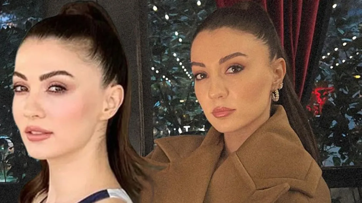 Güneşin Kızları'nın Nazlı'sıydı! Burcu Özberk'in estetiksiz haline bakın nasılmış! Meğer Hande Erçel gibi...