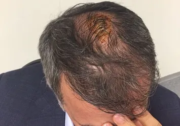 Şenol Güneş'in kafasına 5 dikiş atıldı!