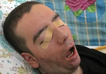 Antalya’da 10 yıldır gözlerini kırpmadan yaşıyor! Adeta kan ağlıyor