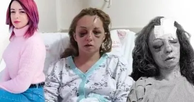 Mersin’de mezarlıkta dehşeti yaşadı! Genç kız 5 günün sonunda yoğun bakımdan çıktı | Kan donduran olayı anlattı