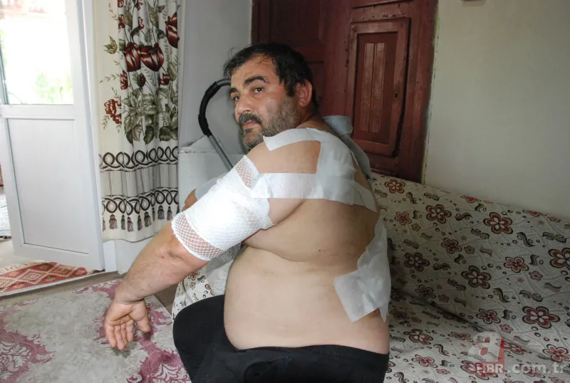 Bartın'da ayı saldırısı! 65 dikiş atıldı: Öldüğümü sanıp bıraktı 8