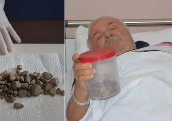 Mesanesinden binden fazla taş çıktı