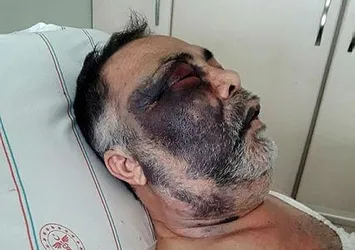 Antalya'daki vahşetten acı haber! Mümin Kara hayatını kaybetti!