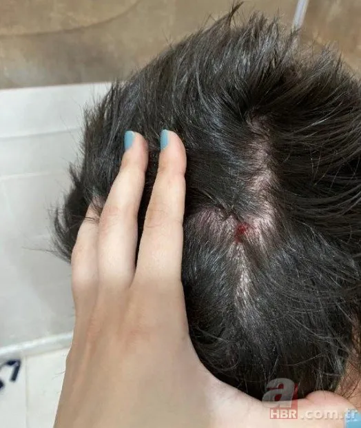Diyarbakır’da Amed SF - Fenerbahçe Kadın Futbol Süper Ligi maçında kadın futbolcular rakiplerine saldırdı! Tribünlerden yabancı madde yağdı