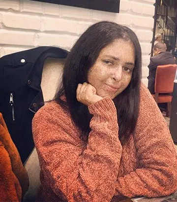 Fatima Ghazaoui, nadir görülen hastalığı yüzünden 20 yıldır gün ışığına çıkmadı | Xeroderma pigmentosum nedir?