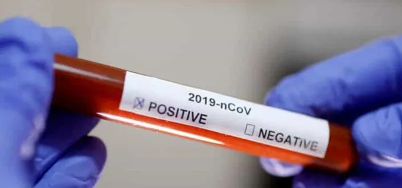 Meksika'da son 24 saatte koronavirüsten dolayı 523 kişi hayatını kaybetti