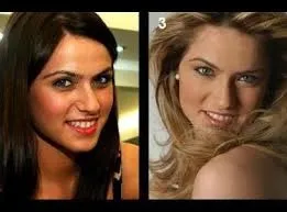 Ceyda Ateş’ten estetik itirafı! Set kazası kabusu oldu 3 kez ameliyat masasına yattı 9