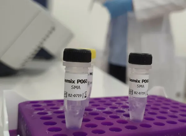 Omicron varyantı Türkiye’de görüldü! Bakan Koca Omicron varyantının görüldüğü illeri tek tek açıkladı!