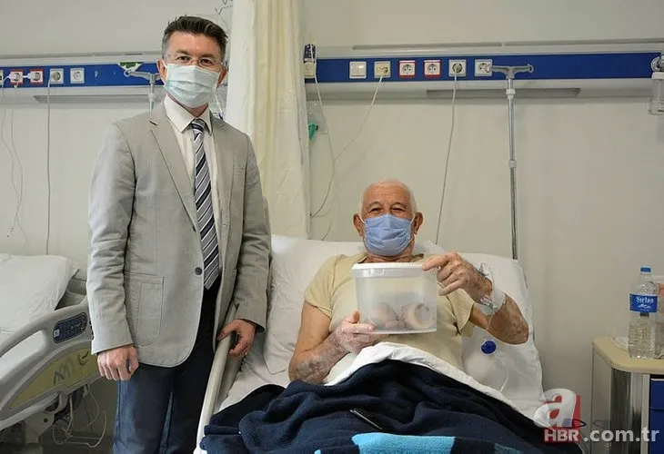 Karın bölgesinde şişlik ve halsizlik şikayetiyle doktora gitti! Karnından çıkanlar şoke etti 10