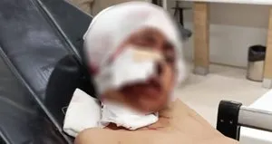 Erzurum’da sokak köpeği dehşeti!