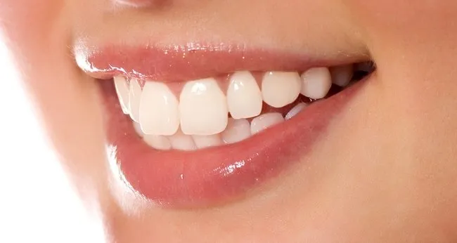Doğal diş beyazlatma yolları! Doğal yöntemlerle diş beyazlatma!