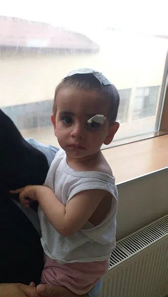 Ağrı’da 2 yaşındaki Ali Asaf Aktekin köpeklerin saldırısı sonucu öldü