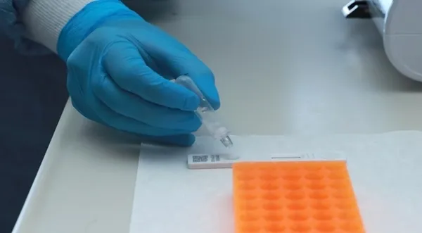Türk bilim insanları koronavirüs tanısı için yeni sistem geliştirdi - 2