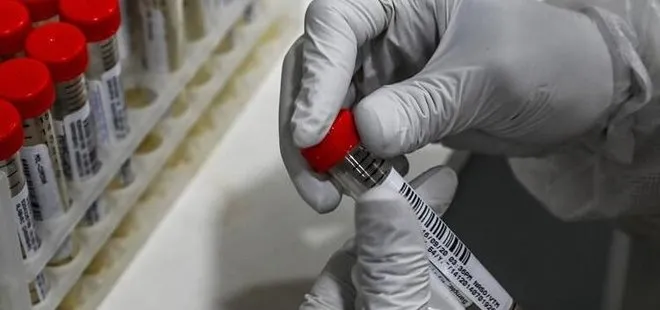 Son dakika: AstraZeneca - Oxford tarafından geliştirilen koronavirüs aşısı piyasaya çıkıyor!