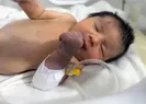 Enkazda doğan mucize bebek