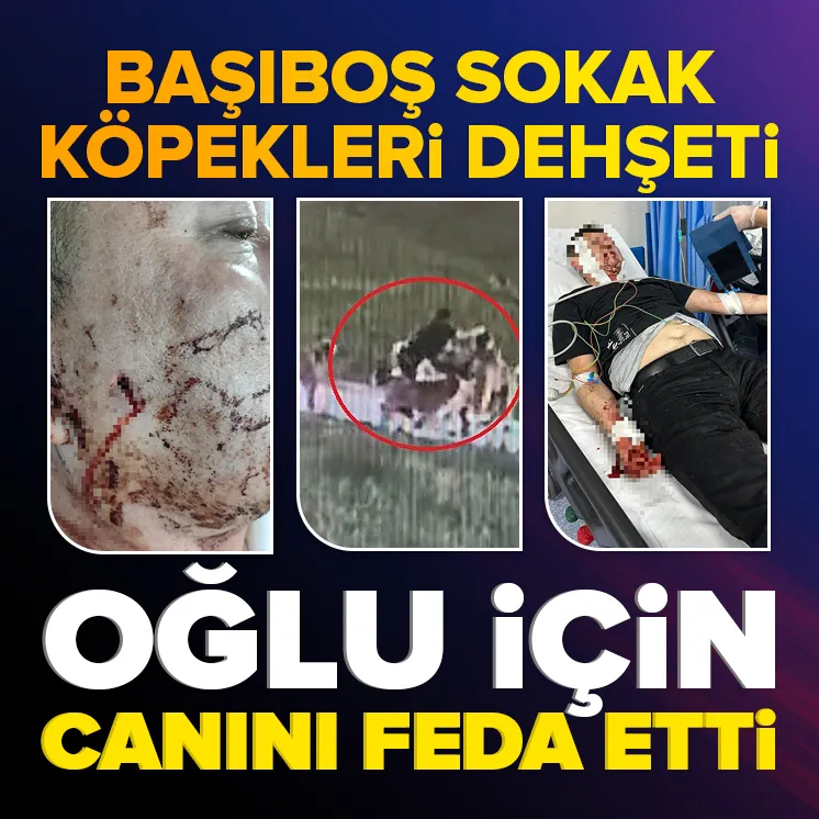 Bursa’da başıboş köpek dehşeti kamerada!