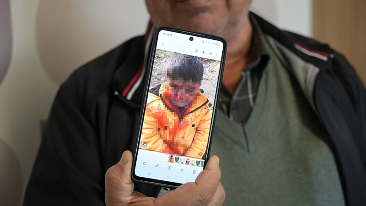 Adıyaman'da kuduz paniği! 6 yaşındaki çocuğun yürek yakan hali