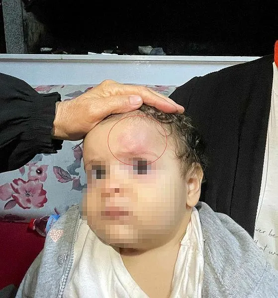 orduda-restoranda-darbedilen-savci-mucahit-samil-kocanin-ifadesi-ortaya-cikti-1722945099382.jpeg Savcının düşerek yaralanan kızı