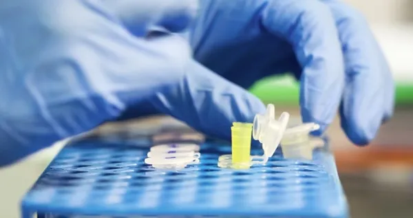 Türkiye'de üretilen koronavirüs testi dünyada bir ilk olacak - 1