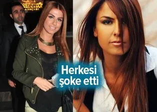 Adanalı dizisinin güzel oyuncusu Tuğçe Özbudak yeni haliyle olay oldu! Estetik yaptırmaktan öyle bir hale geldi ki...